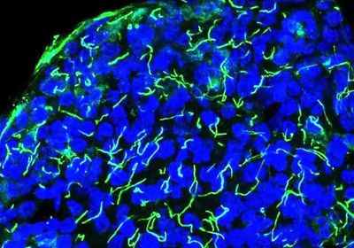 Squiggly green cilia on blue human beta cells Squiggly green cilia on blue human beta cells